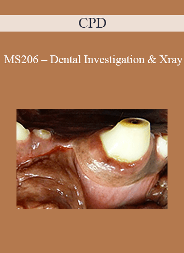 Purchuse CPD - MS206 – Dental Investigation & Xray course at here with price $479 $114.